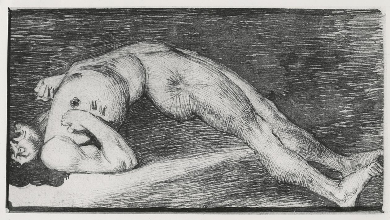 Dibujo de una convulsión epiléptica de French School