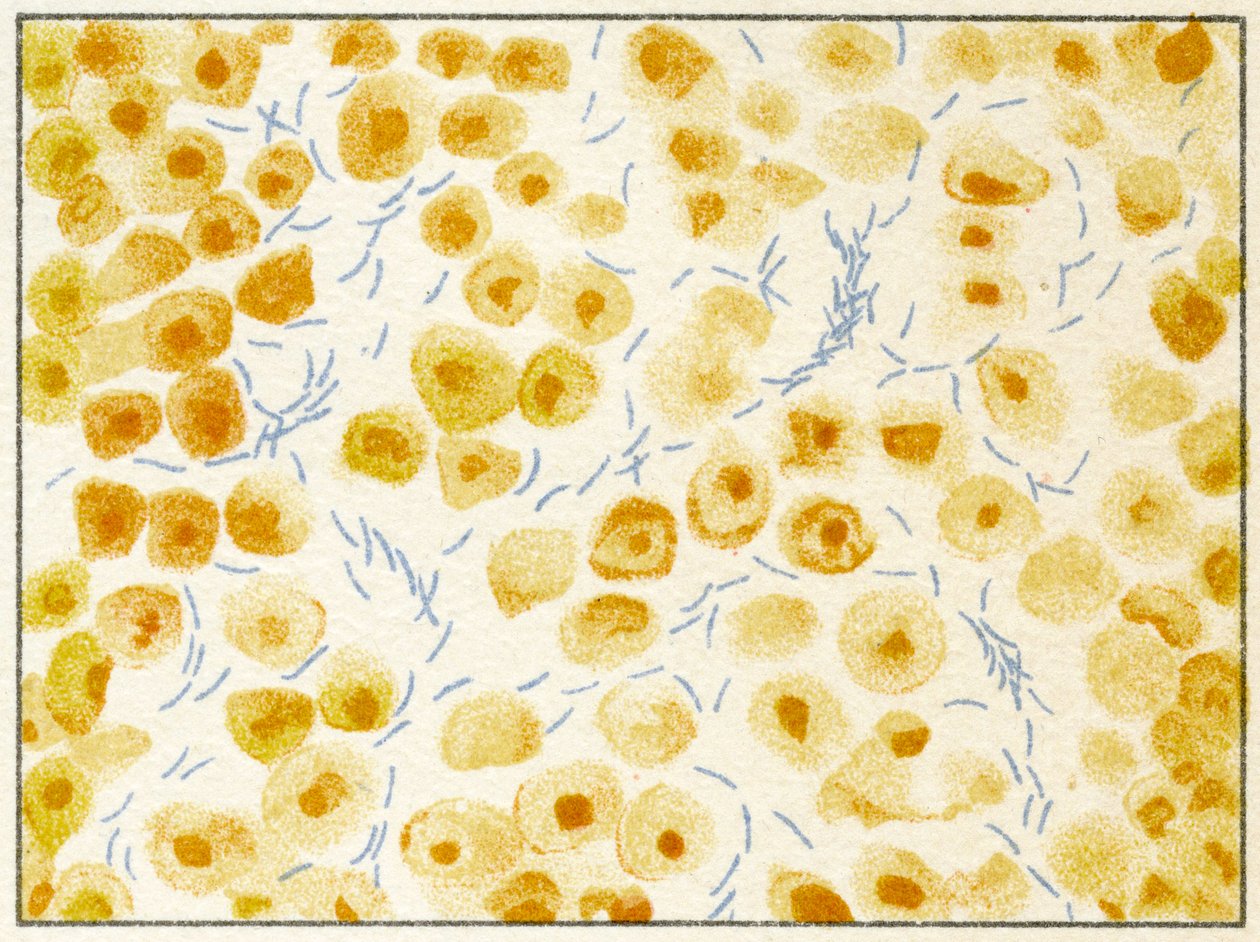 Bacterias de tuberculosis en esputo c.1890 de German School