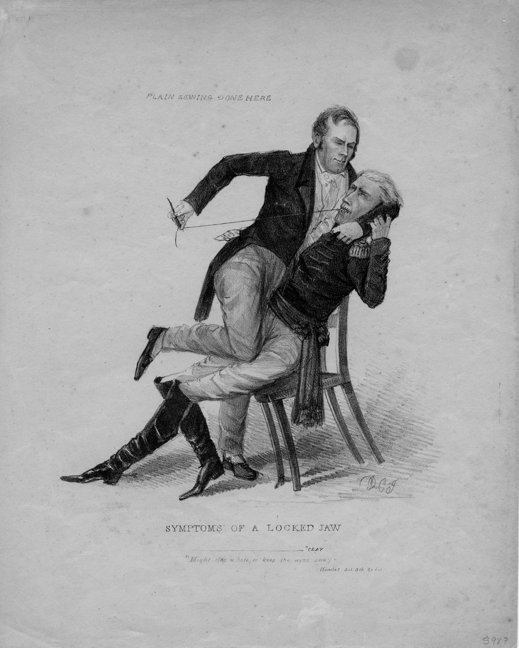 Síntomas de una mandíbula bloqueada, c.1827 de American School