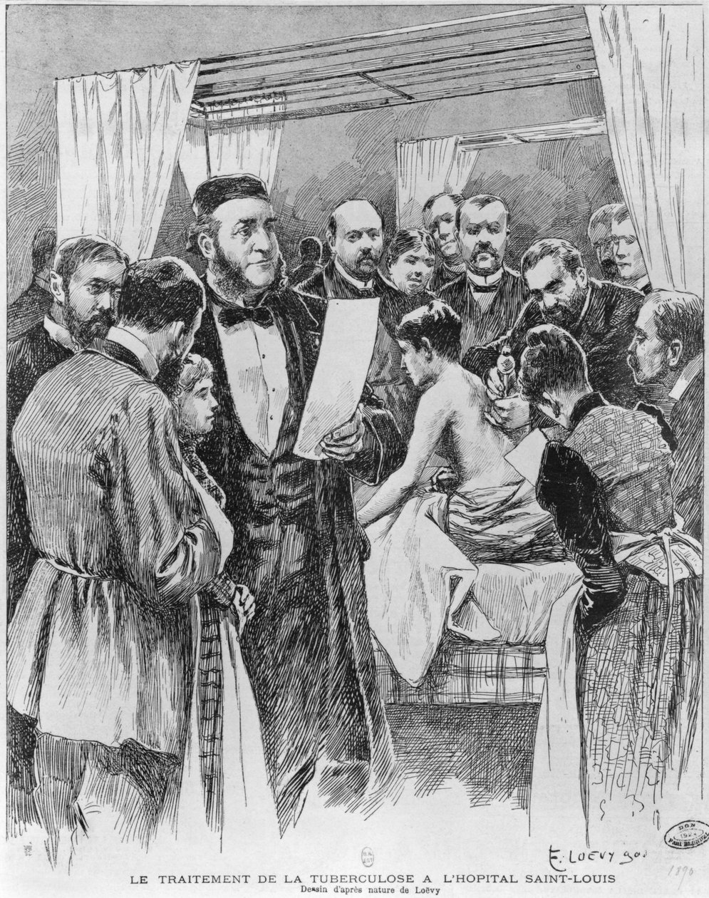 El tratamiento de la tuberculosis en el hospital St. Louis, París, 1890 de Edward Loevy
