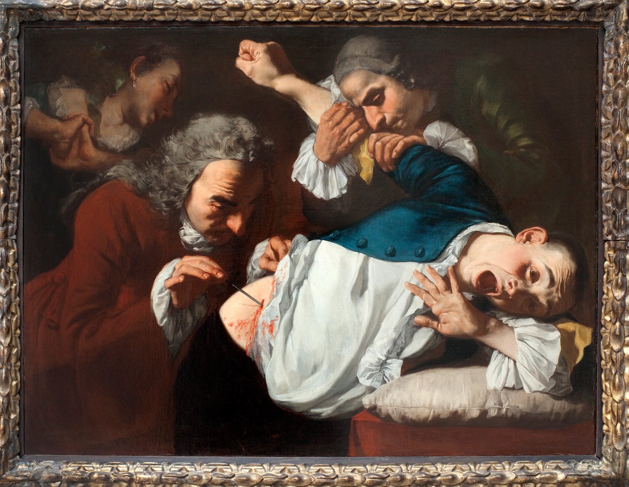 La operación, 1753-54 de Gaspare Traversi