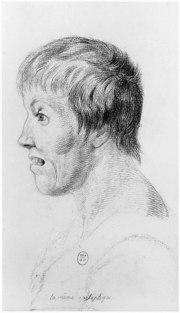 Mujer epiléptica, perfil, ilustración de un tratado inédito de Jean Etienne Dominique Esquirol (1772-1840) sobre los lunáticos del asilo de Salpetriere, c.1818 de Georges Francois Gabriel