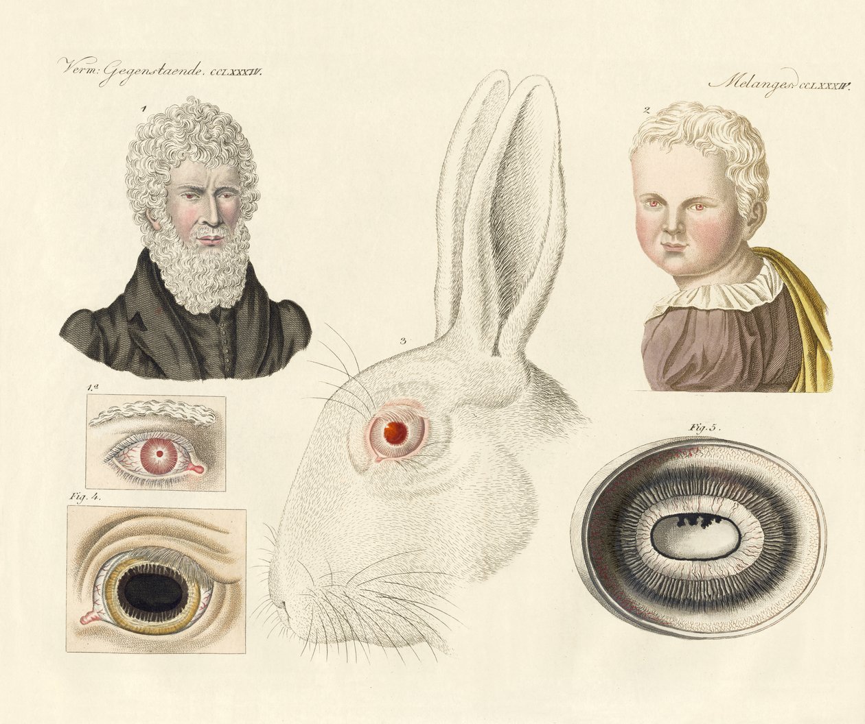 Albinos de German School