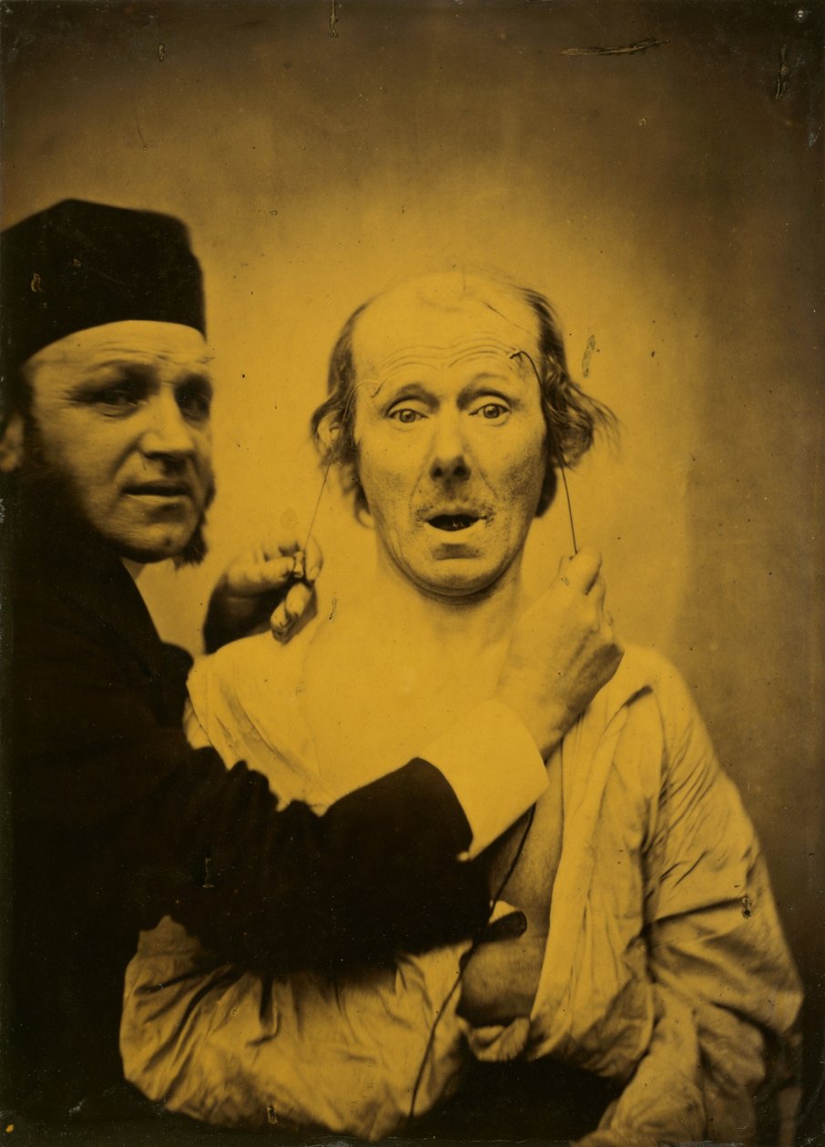 Sorpresa de Guillaume Benjamin Amant Duchenne