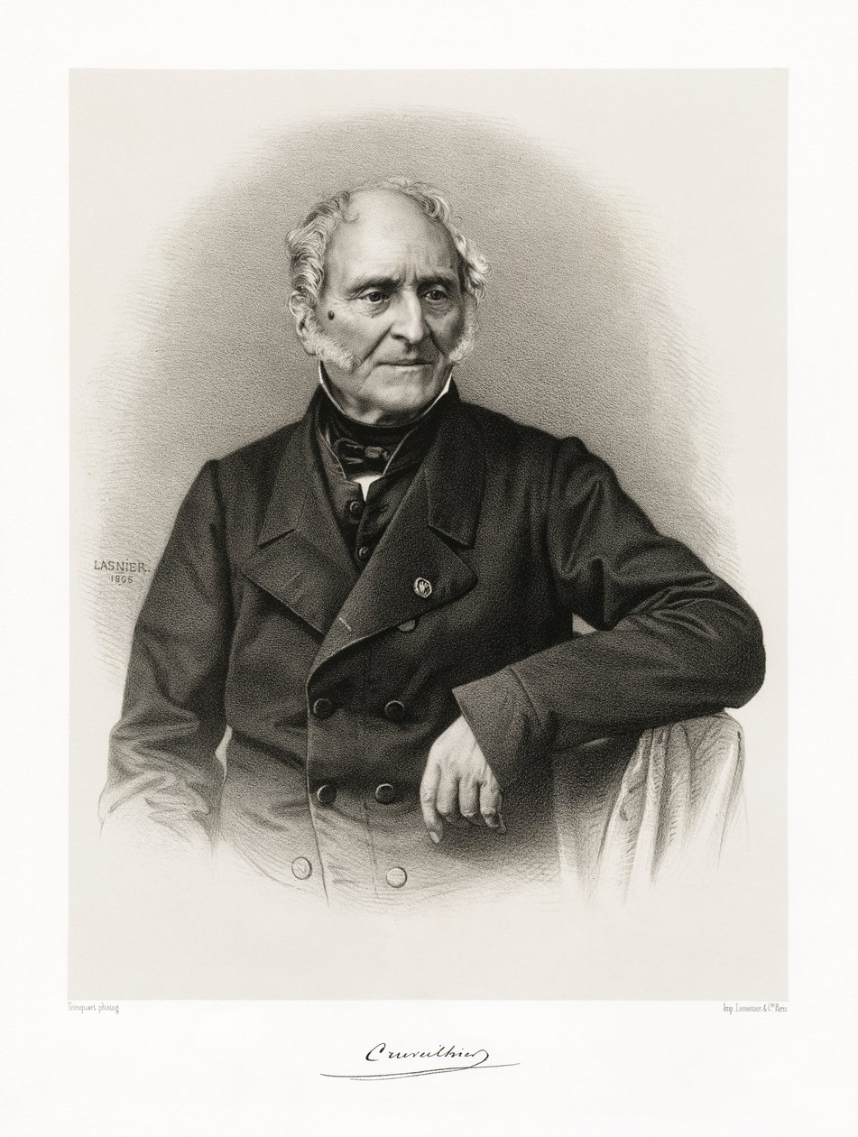 Jean Cruveilhier de Lasnier