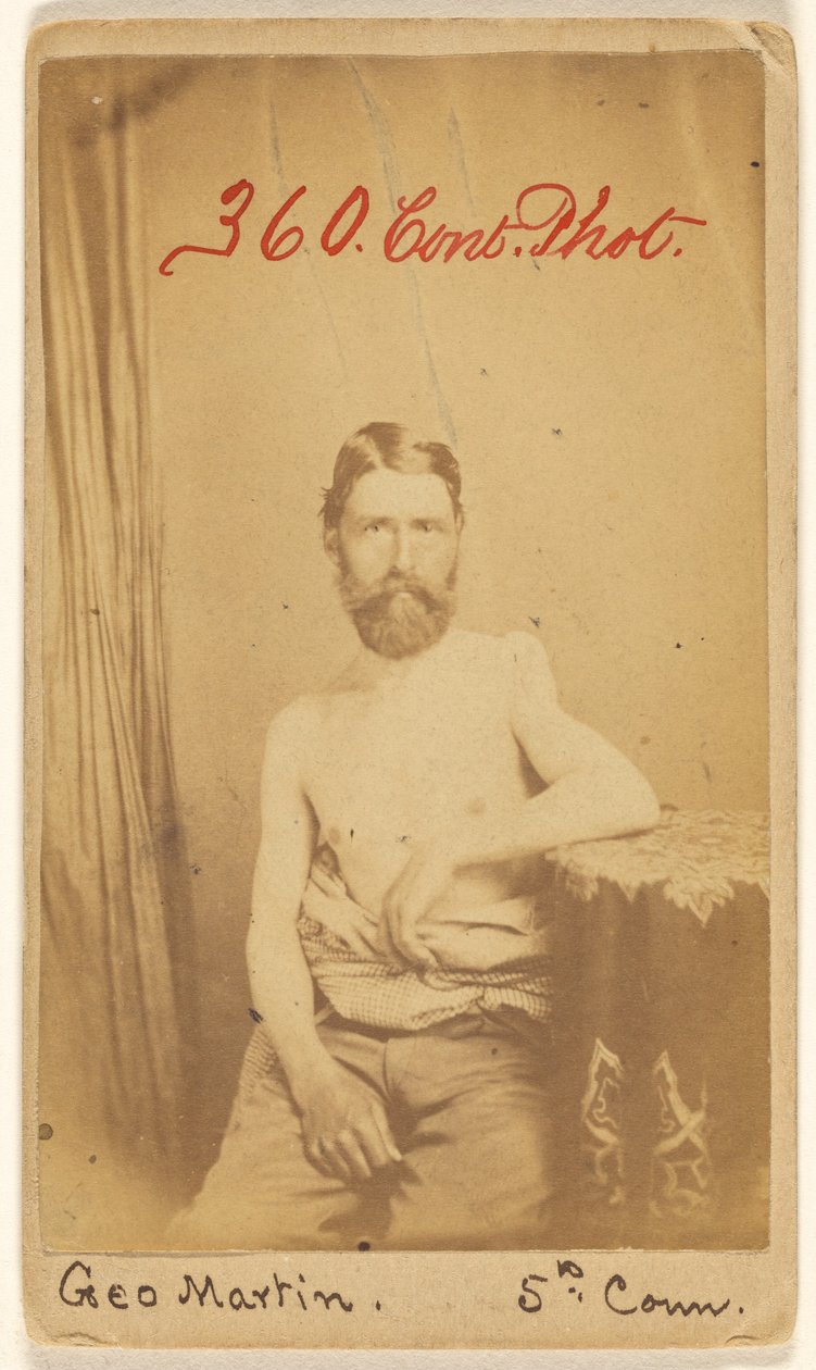 Geo. Martin, 5º Conn. [Víctima de la Guerra Civil] de S. Friedlaender