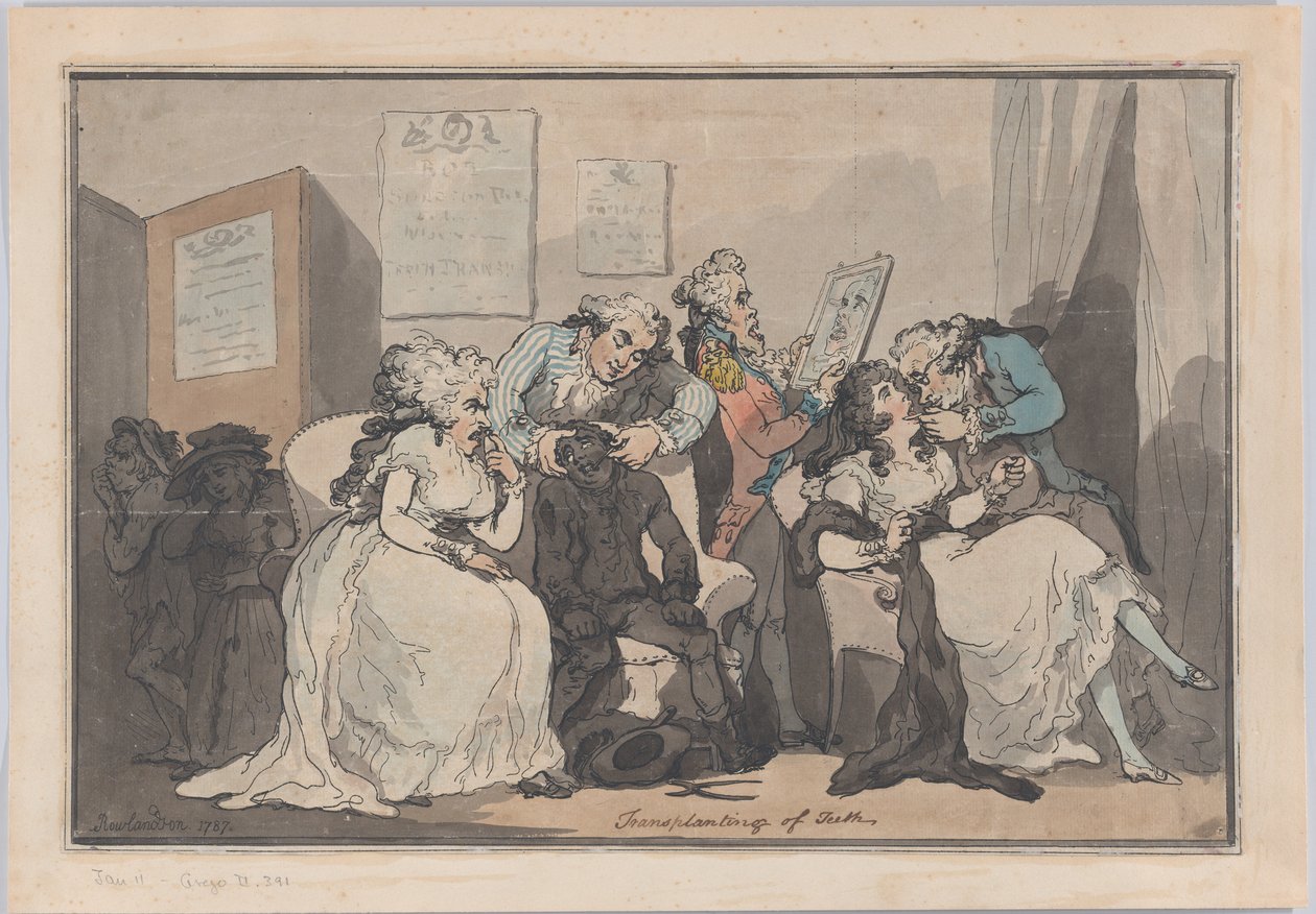 Transplante de Dientes, 1787 de Thomas Rowlandson