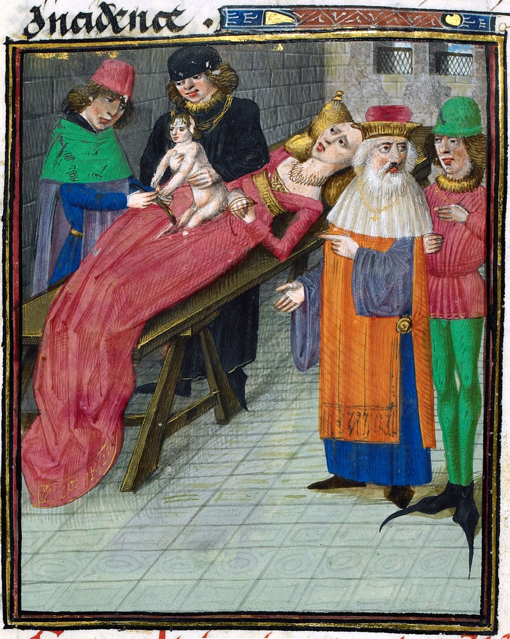Representación medieval del nacimiento por cesárea de Unbekannt Unbekannt