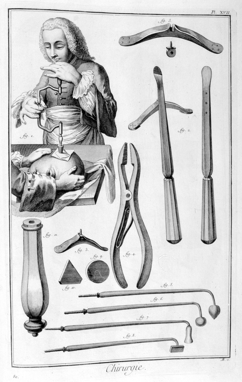 Cirugía de cabeza, 1751-1777 de Unbekannt