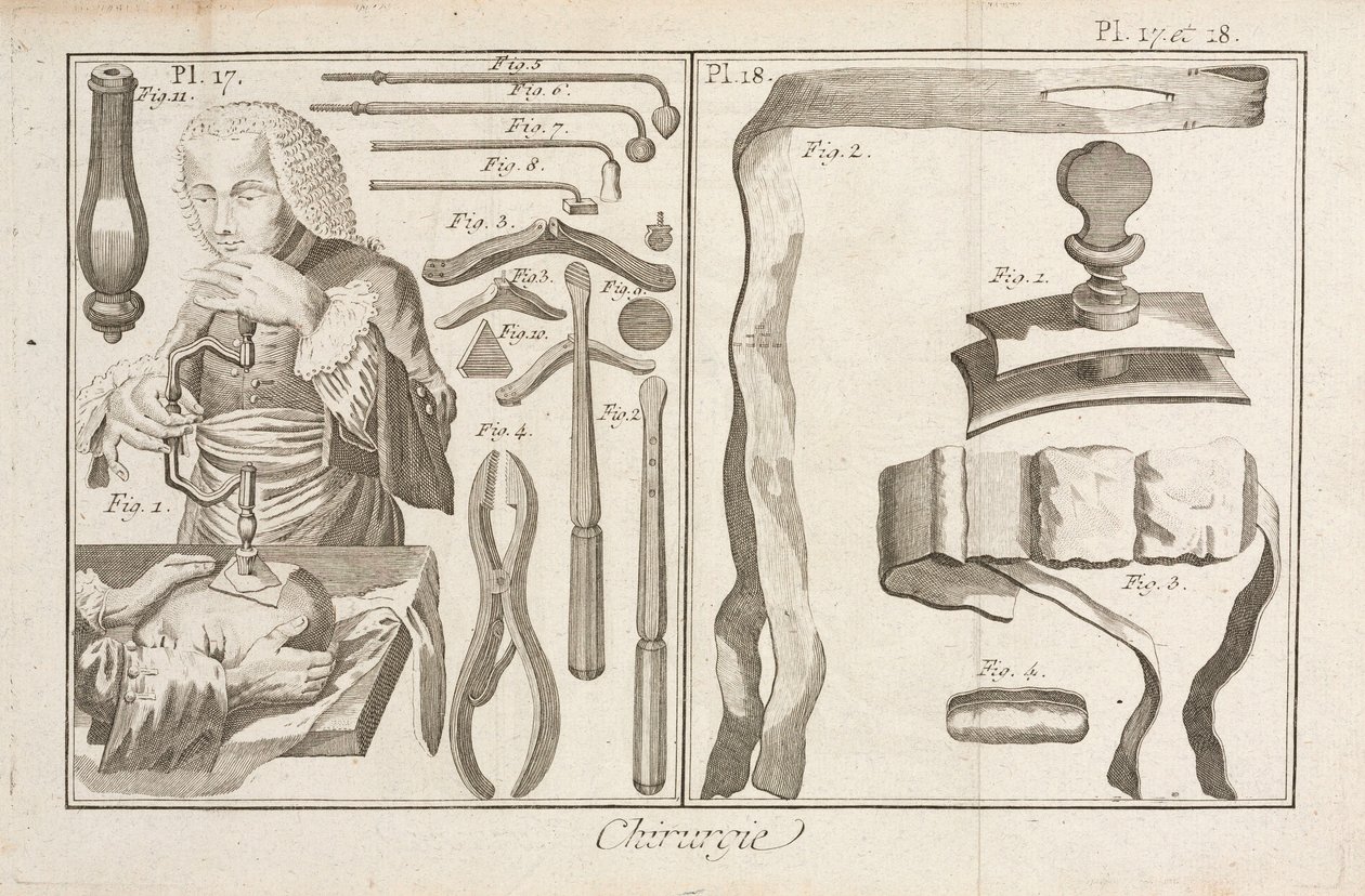 Trepanación de Unbekannt
