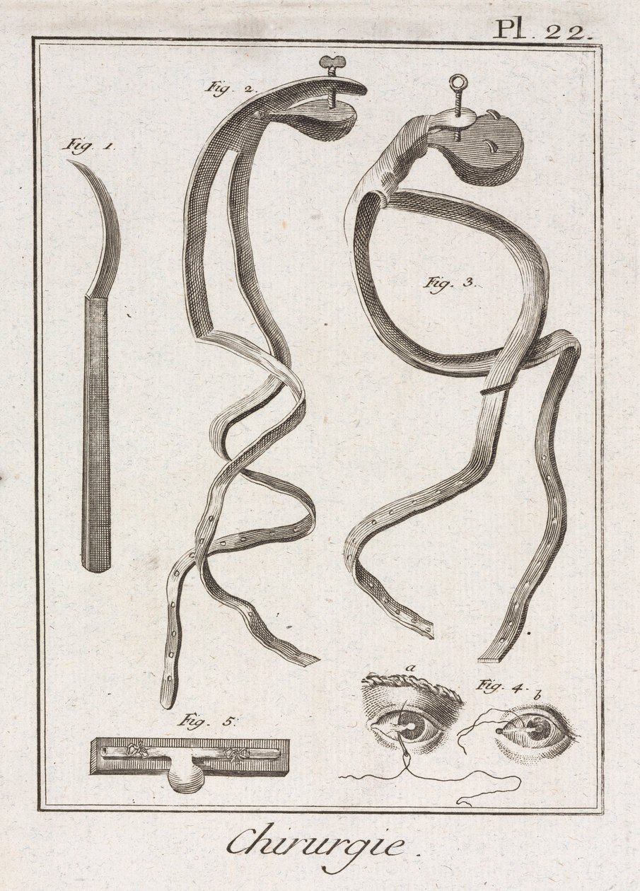 Equipamiento, Cirugía ocular de la Edad Moderna de Unbekannt