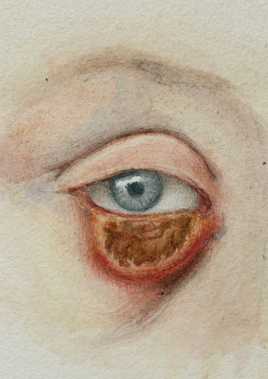 Ojos de Frederick (attr. to) Barnard