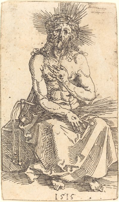 El Hombre de Dolores Sentado de Albrecht Dürer