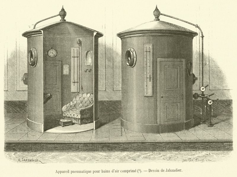 Aparato neumático para baños de aire comprimido de French School