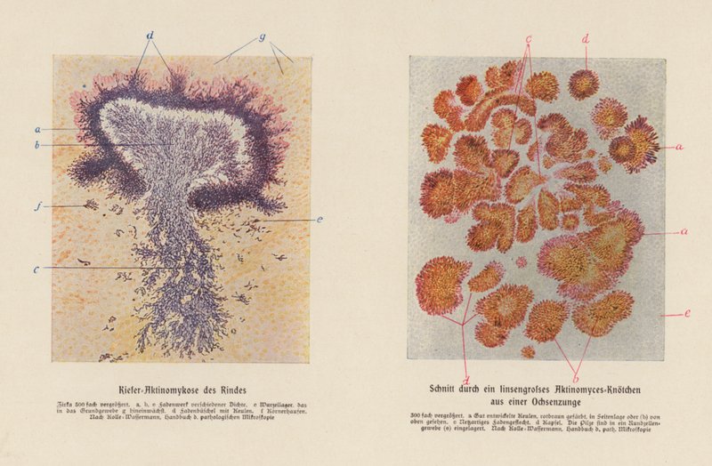 Actinomyces bovis (litografía en color) de German School