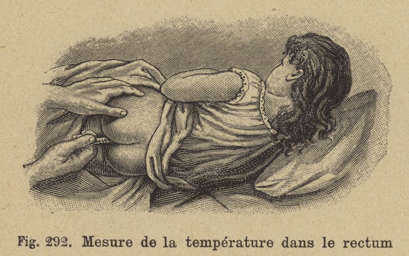 Tomando la temperatura de un niño por el recto de German School